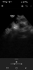 Ultraschall