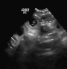 Ultraschall